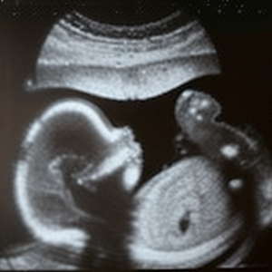 Planned Parenthood ist stolz auf mehr als 1200 tote Kinder pro Tag