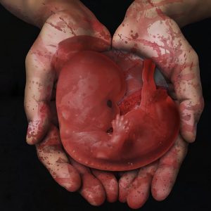 Zum aktuellen Gesetzesentwurf der Bundesregierung: Abtreibungen – Teil eines Bevölkerungsreduktionsprogramms?