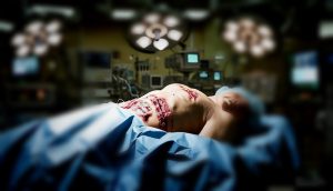 Organspende: CSU will Sterbende zu Leibeigenen erklären