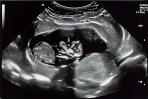 Monaco: Fürst Albert stoppt Liberalisierung – ein klares Zeichen für den Schutz ungeborenen Lebens