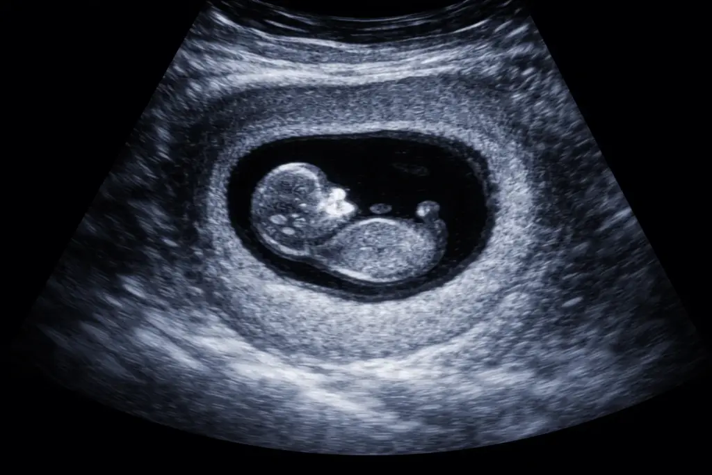 Britisches Oberhaus kippt Schutz: Abtreibung faktisch bis zur Geburt entkriminalisiert